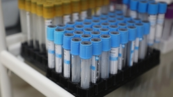 Единичный случай заболевания корью зафиксирован в Ессентуках